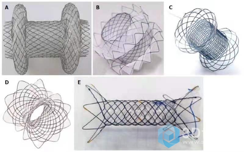 STENT1.jpg